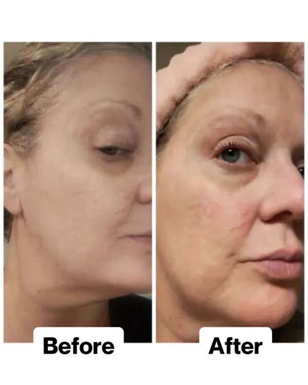A customer's face before and after