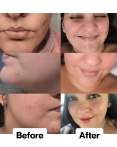 Customer result