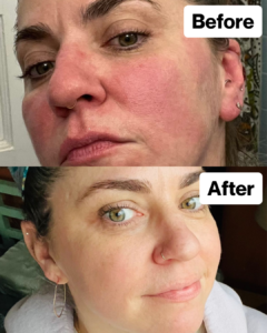 Customer result