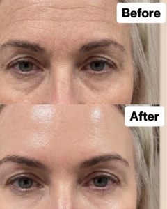 Customer result