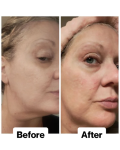 Customer result