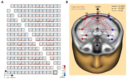 Diagram of the 256 electrode array used in the Norwegian handwriting study